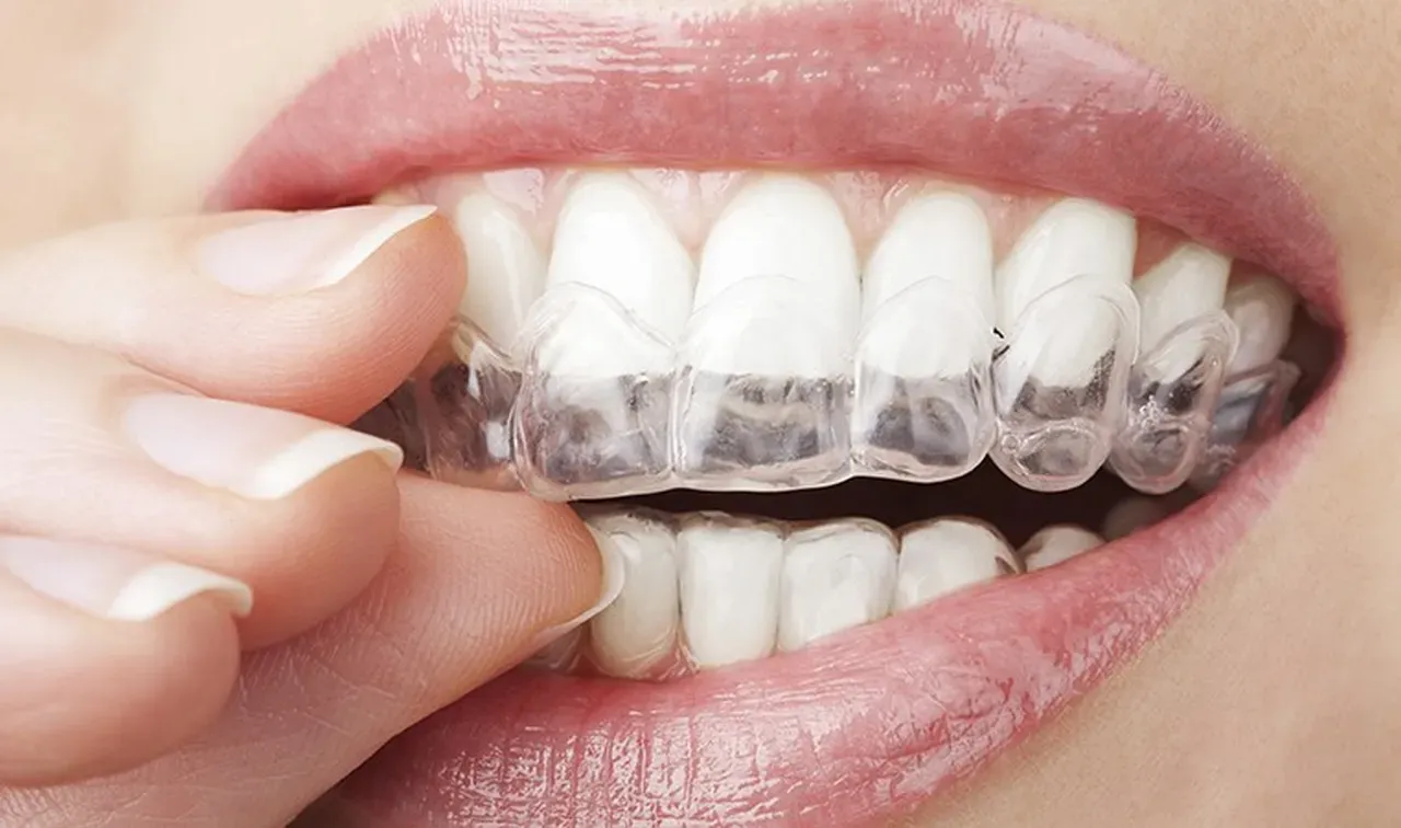Is Invisalign® the Best Choice for Adults?