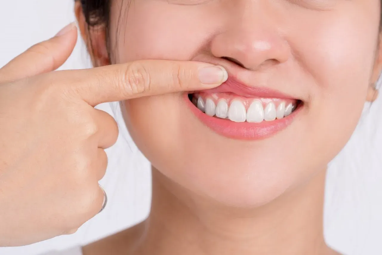 Laser Gum Reduction: Your Step-by-Step Guide