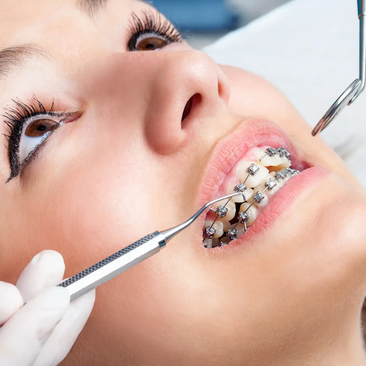 My Braces are Poking Me: Can I Fix Them on my Own?