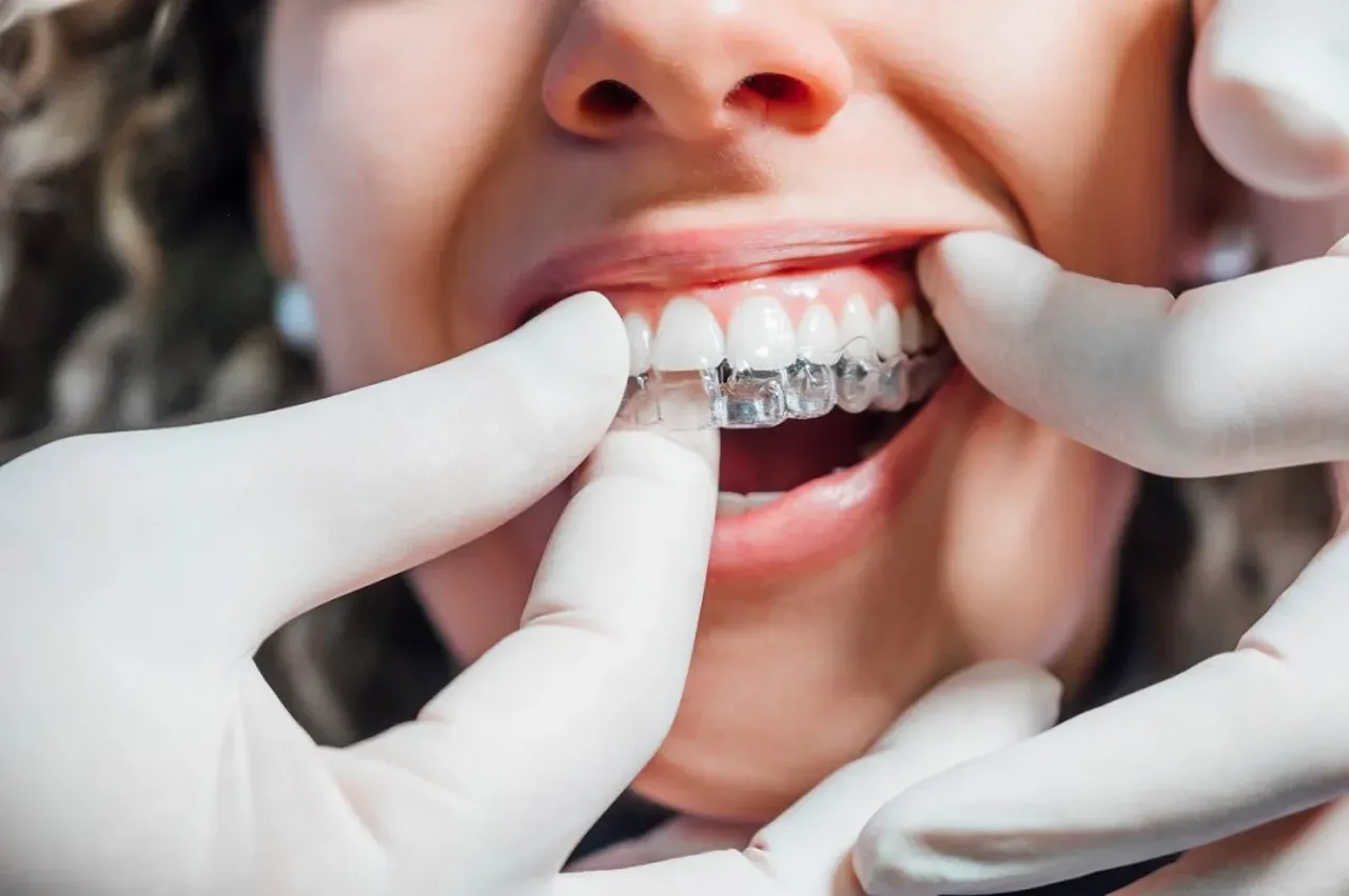 My Retainer Broke: Do I Have an Orthodontic Emergency?