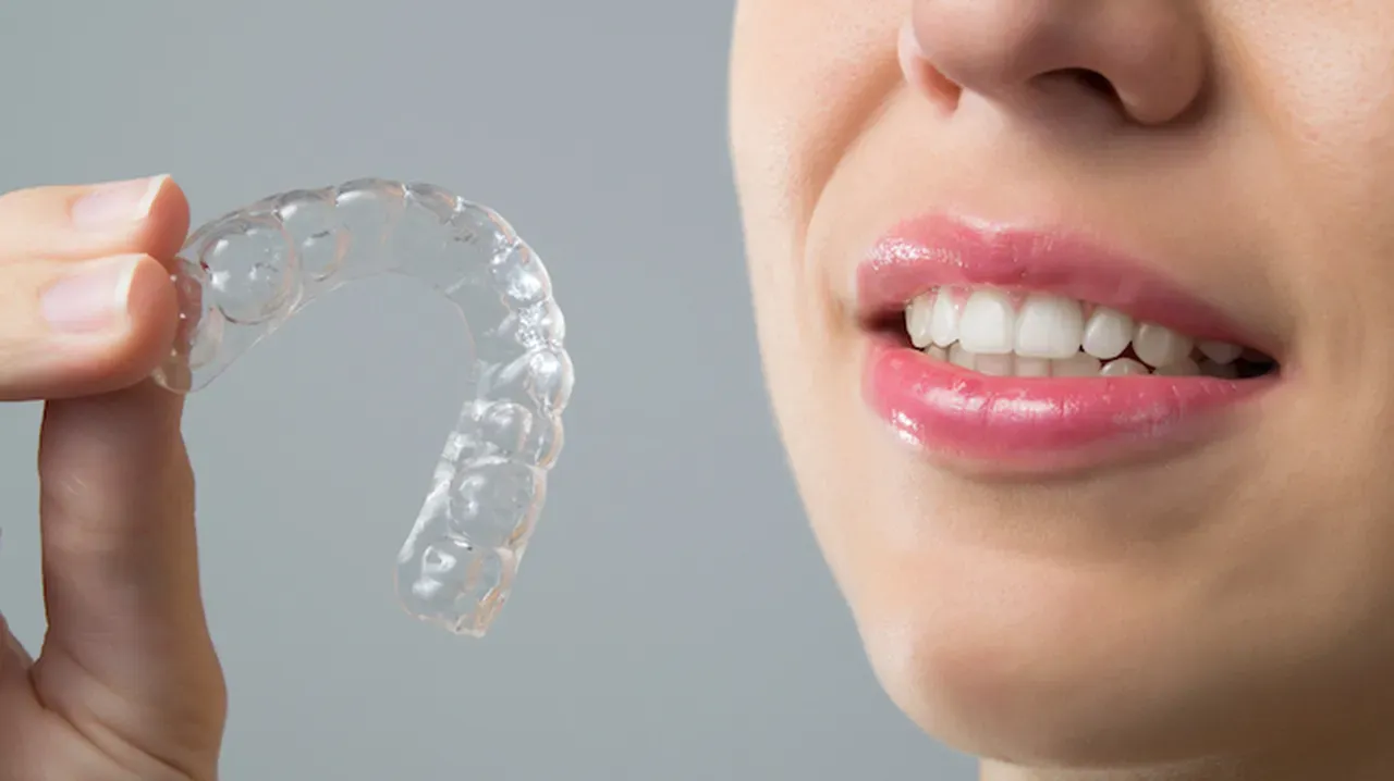 Can Invisalign® Correct My Overbite?