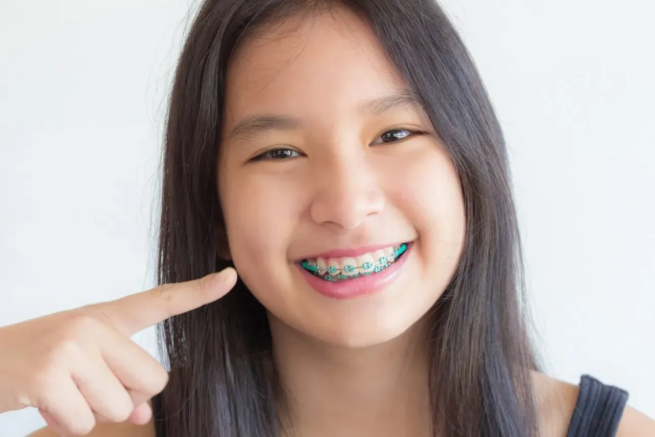 Is There a “Right Age” to Get Braces During Adolescence?