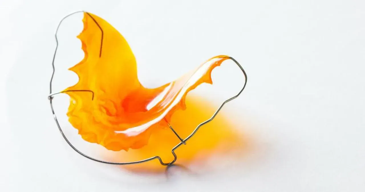 The Importance of Wearing Your Retainer