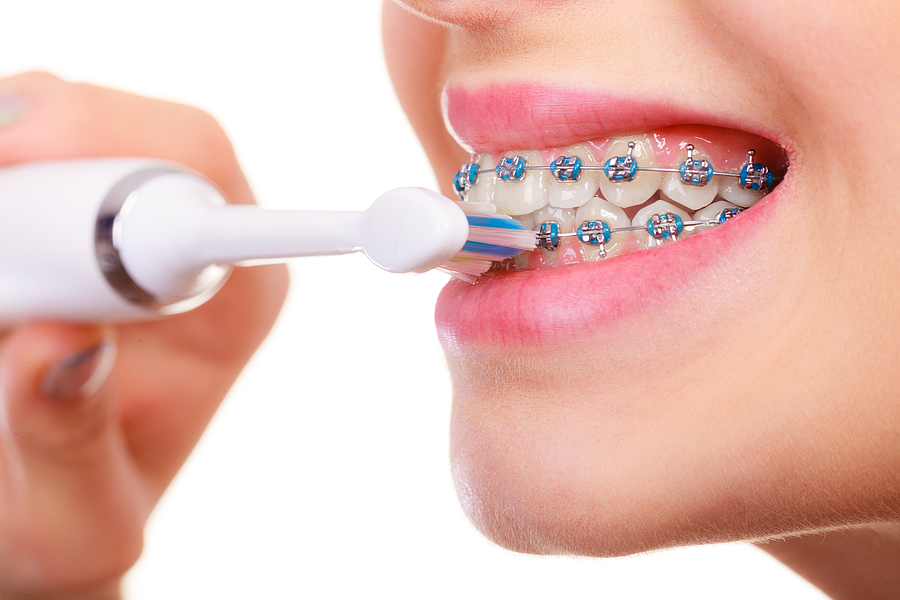 Understanding Orthodontics: The Science Behind How Braces Move Your Teeth
